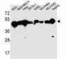 CYK18 Antibody (C-term)